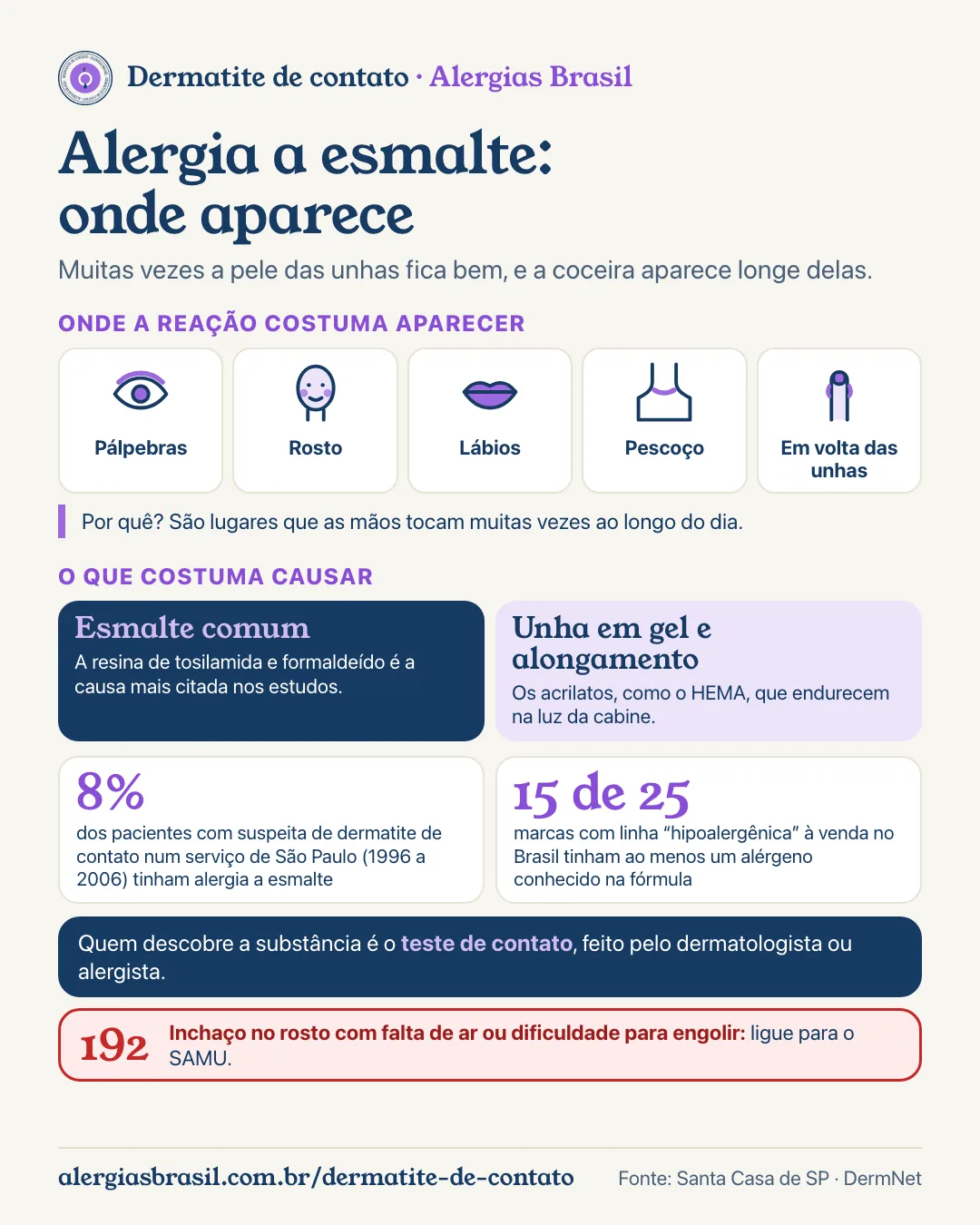 Infográfico alergia a esmalte, onde aparece: pálpebras, rosto, lábios, pescoço e em volta das unhas, lugares que as mãos tocam muitas vezes ao longo do dia. No esmalte comum, a resina de tosilamida e formaldeído é a causa mais citada; na unha em gel e no alongamento, os acrilatos, como o HEMA. 8% dos pacientes com suspeita de dermatite de contato num serviço de São Paulo tinham alergia a esmalte; 15 de 25 marcas com linha hipoalergênica tinham ao menos um alérgeno conhecido na fórmula. Quem descobre a substância é o teste de contato. Inchaço no rosto com falta de ar: ligue 192