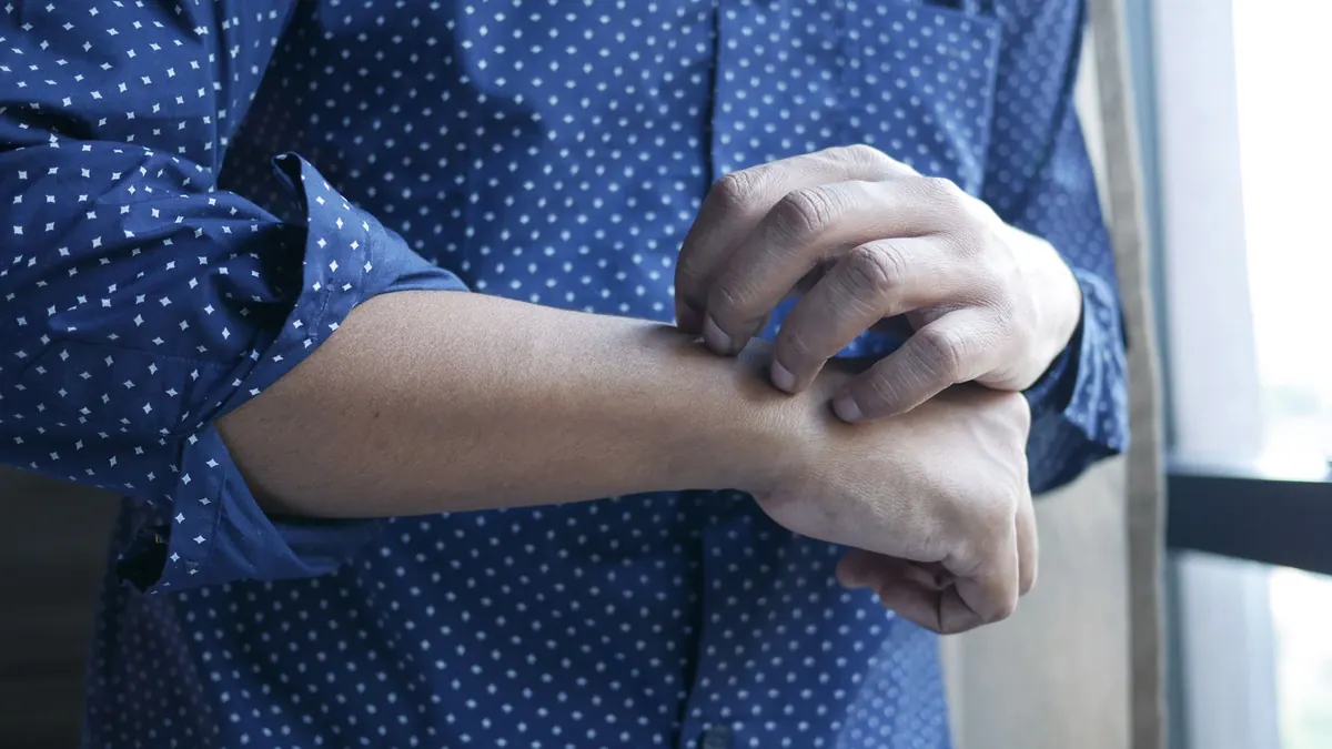 Homem de camisa azul coçando o antebraço